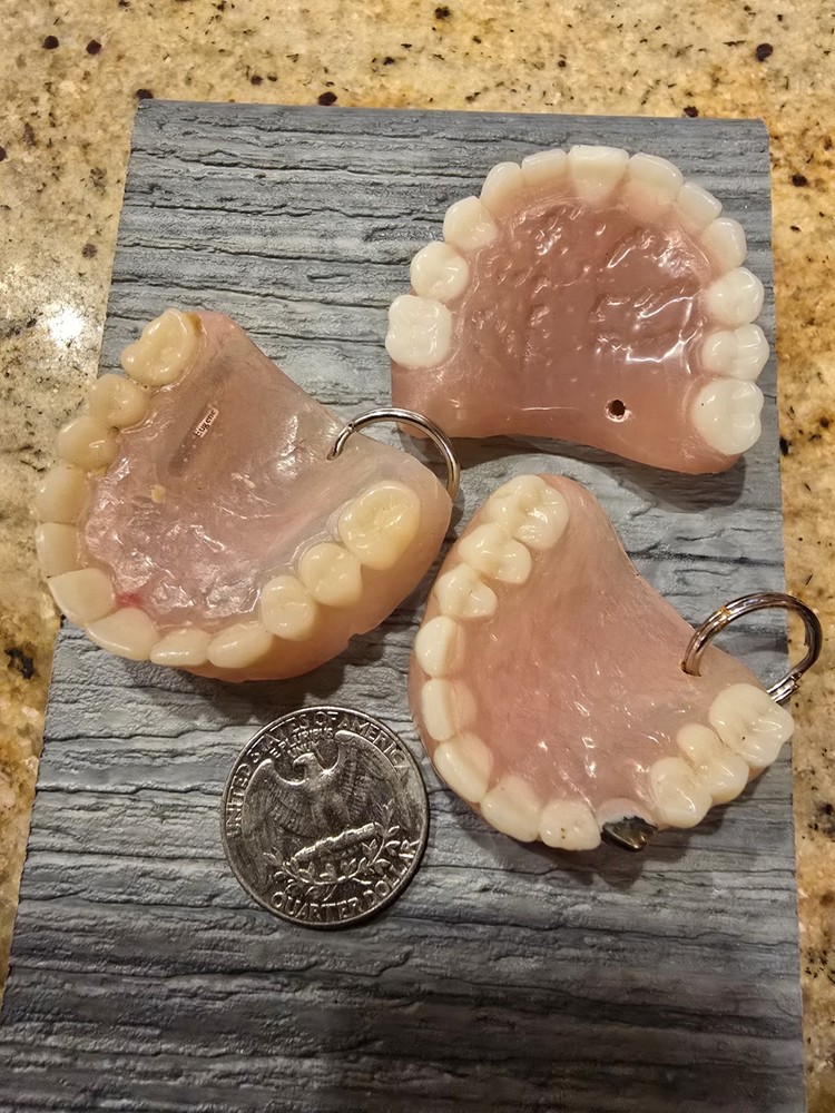 Keychain denture