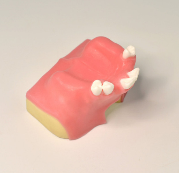 Dental Implant Model Maxillary Sinus Jaw Lift Practice Study Teeth Training
