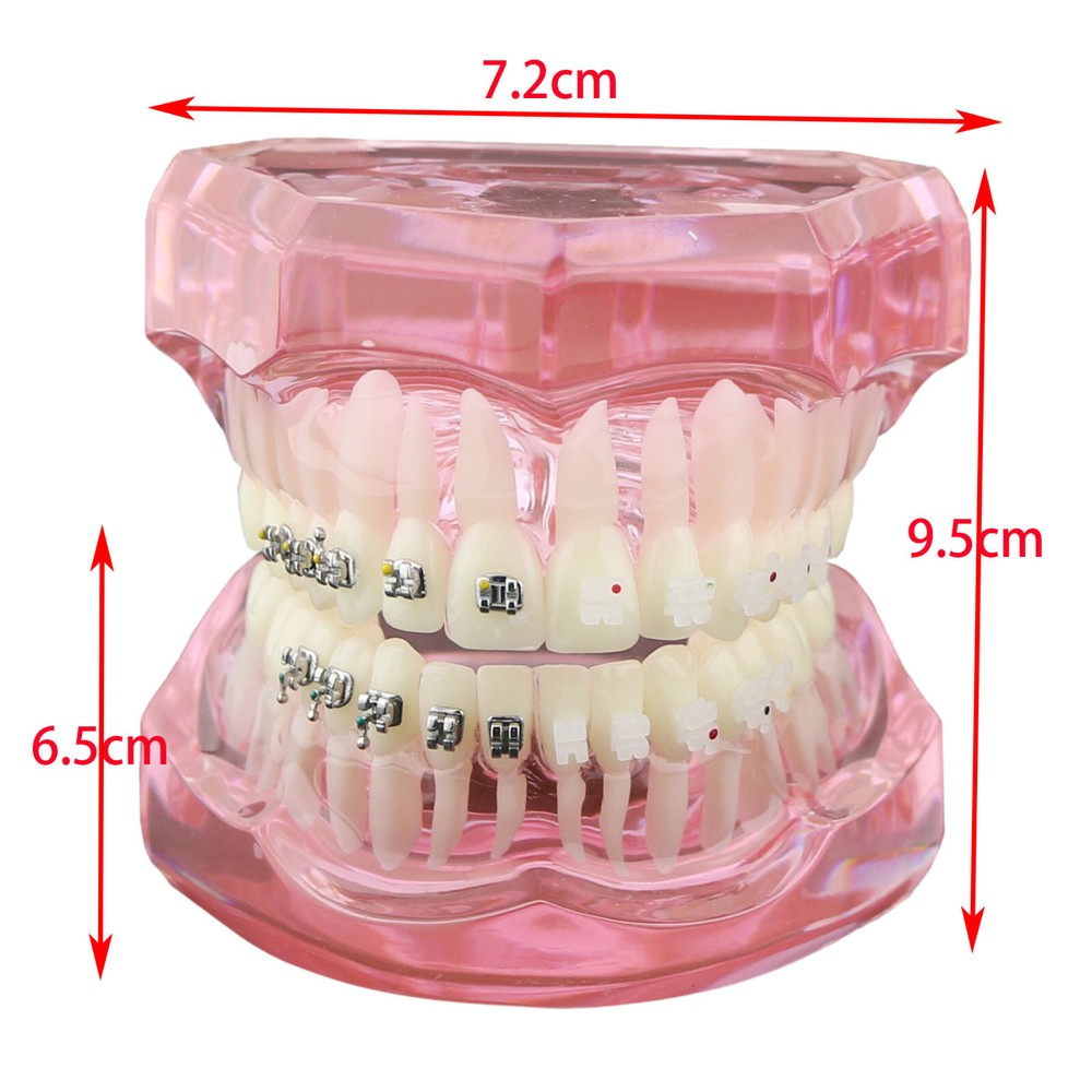 Dental Orthodontic Teeth Model Metal and Ceramic Bracket Study Teach Model 3003
