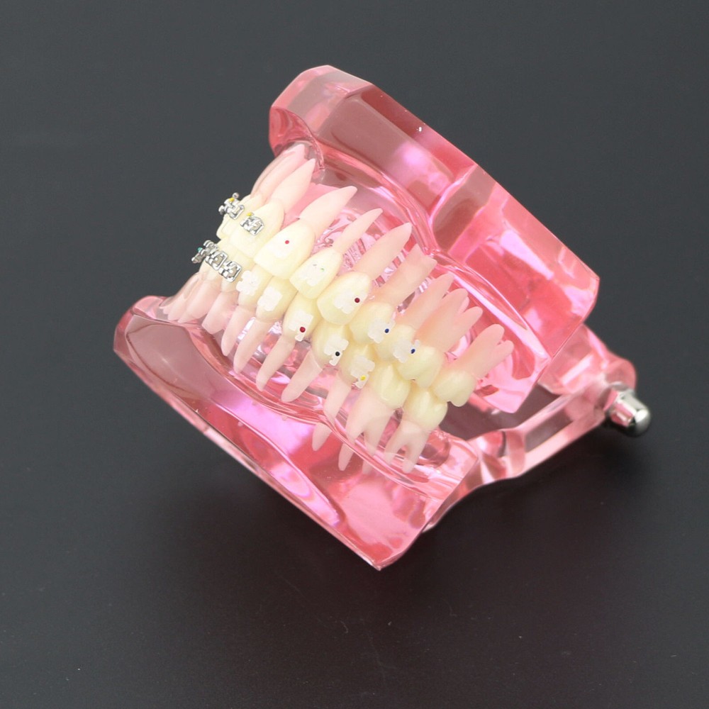 Dental Orthodontic Demonstration Ceramic and Metal Bracket Study Typodont Model