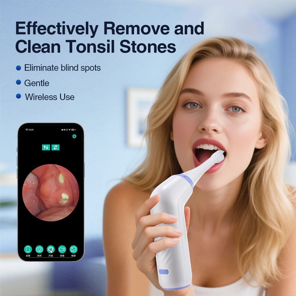 Electronic Visible Tonsil Stone Remover Kit with HD Camera Built-in LED Light