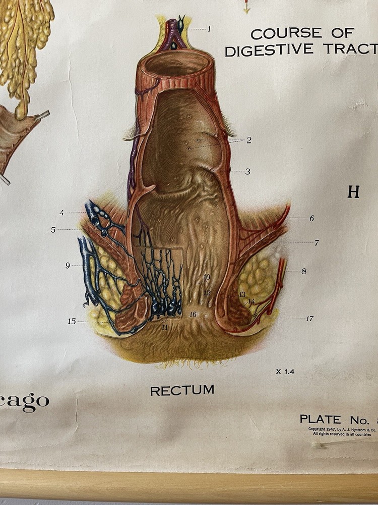 Vintage Frohse American Anatomical Pull Down Wall Chart Digestive System
