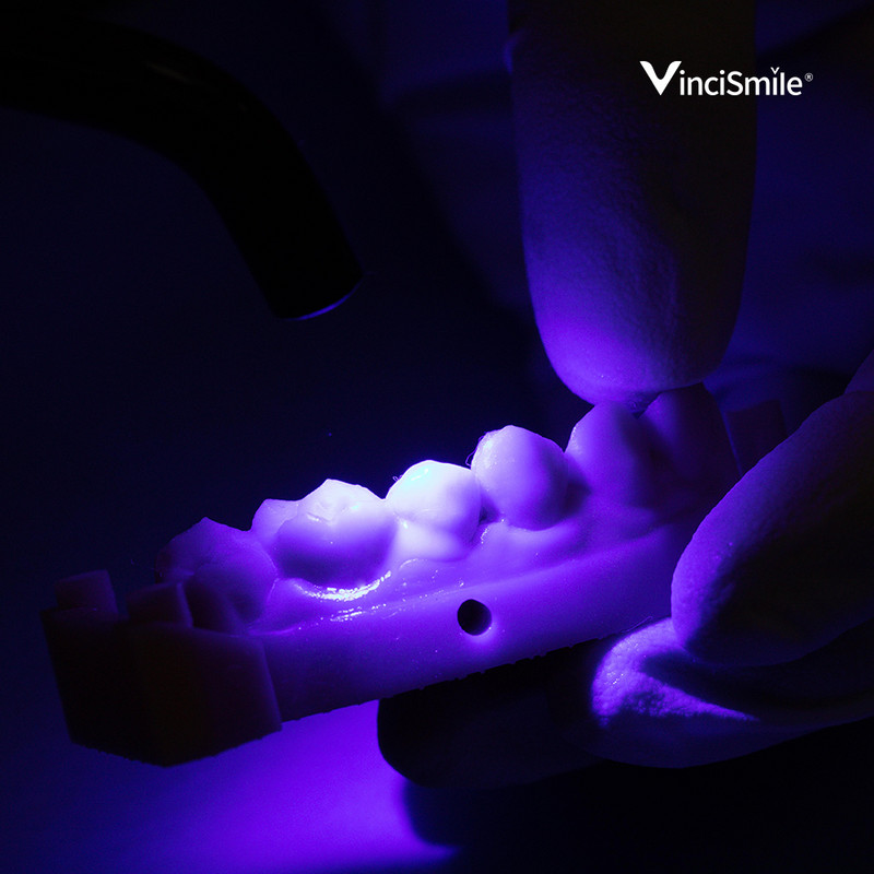 HUGE TOPCEM Veneer System- Veneer Cement Cementation Restorations KIT