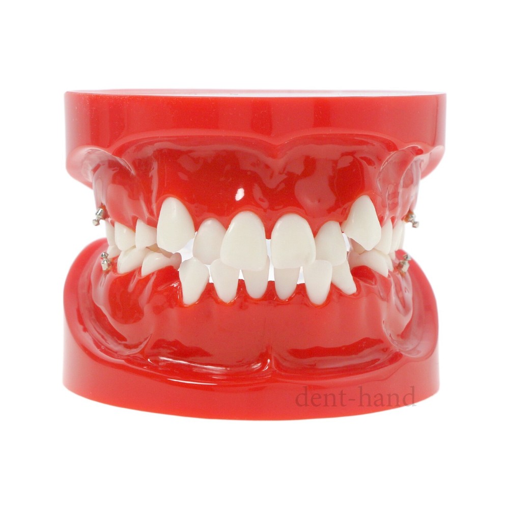 Dental for Orthodontics Teach Study Treatment Model M3005