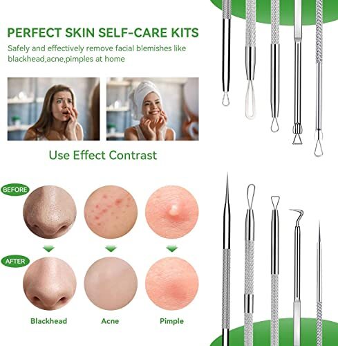 Pimple Popper Tool Kit,Blackhead Remover Tool 5 Pcs Blackhead Extractor Tool