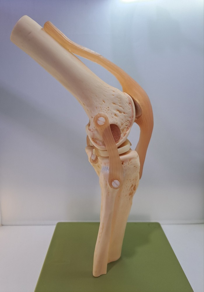Vintage 1995 Somso Anatomical Model Functional Knee Joint Model BIN86