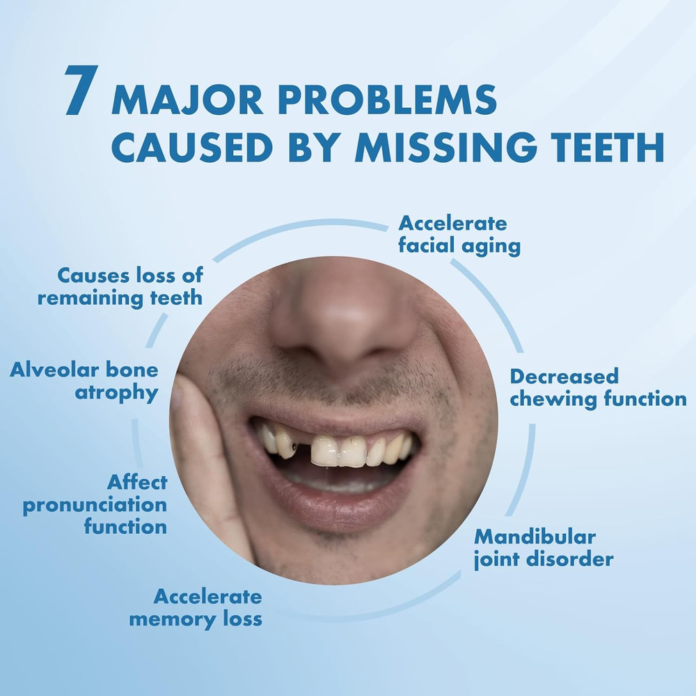 Custom Removable Dentures – Personalized Partial Denture Set for Tooth Replaceme