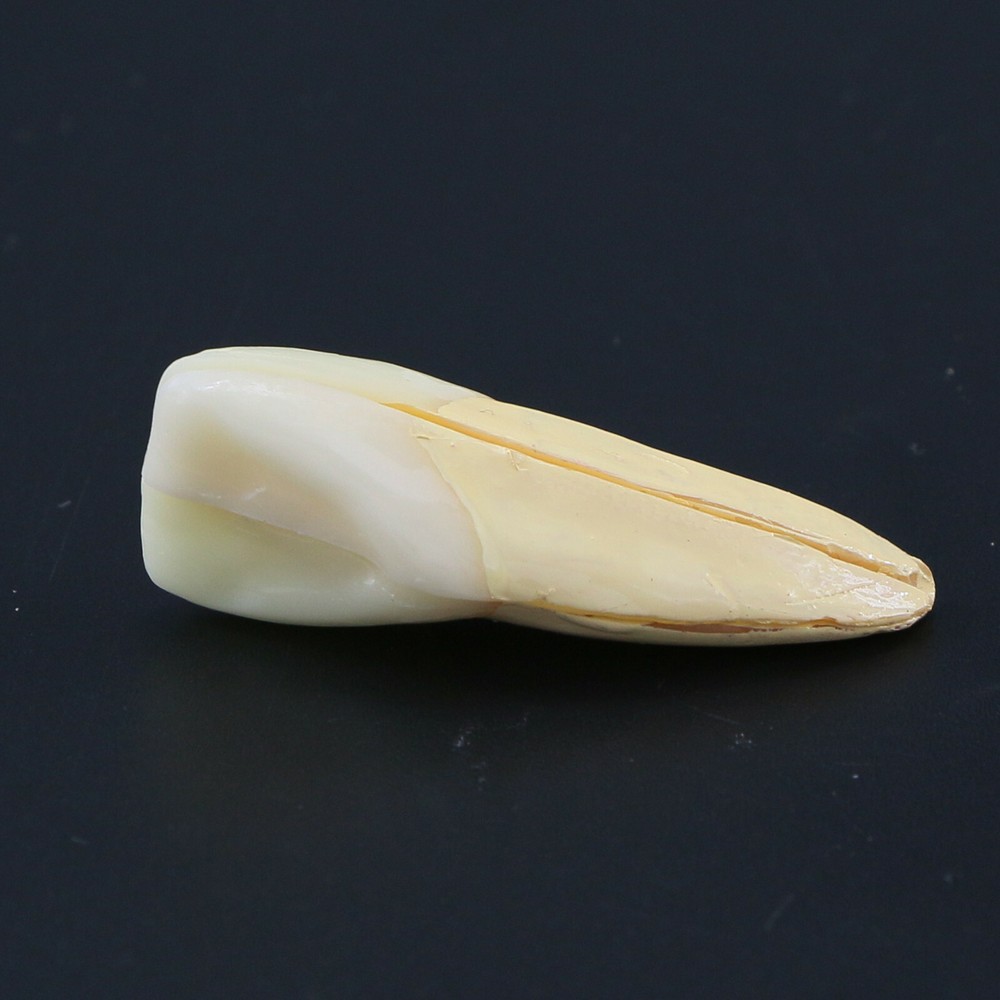 Endodontic Treatment Root Canal Tooth Teach Study Dental Teeth Removable Model