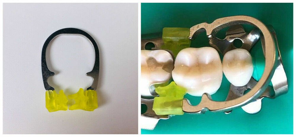 Dental Standard/Power/Soft/Hard Sectional Matrix Matrices Ring Clamp Holder