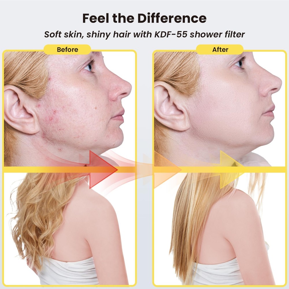 Ryamen Filtered Shower head, Rain Head with Filter, High Silver