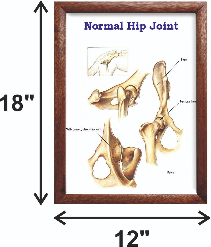Normal Hip Joint Chart 12x18 inches