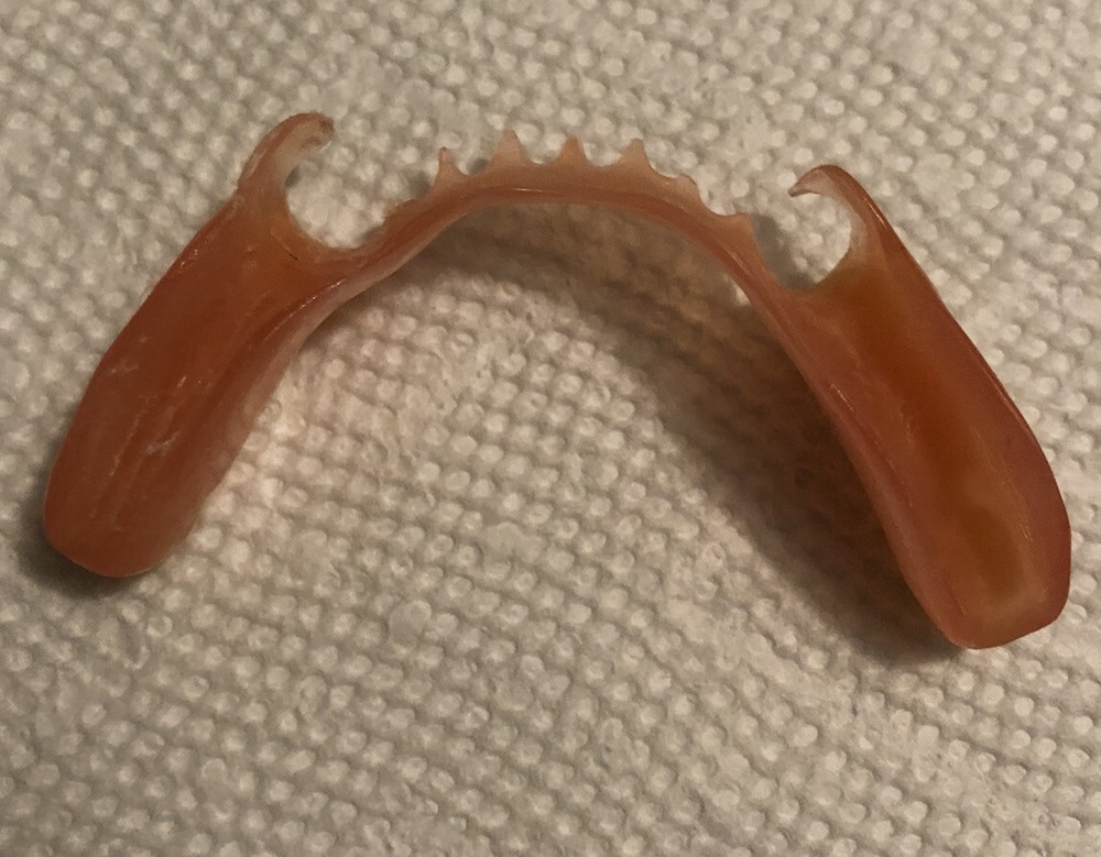 BURBANK Replacement DentalLab Partials Lower Side 6 teeth CustomMadeMissingTooth