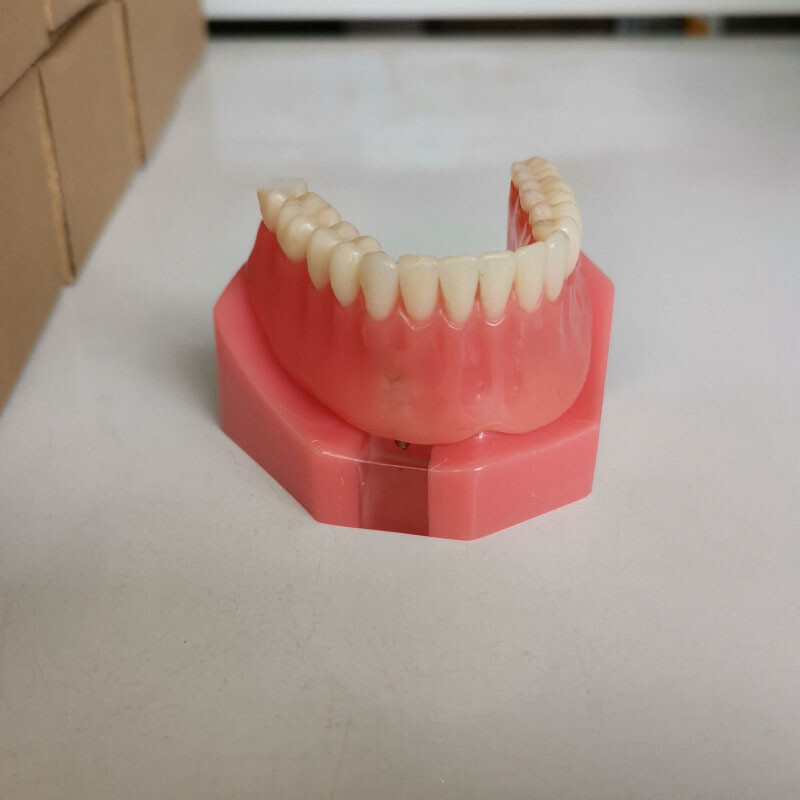 Dental Orthodontic Teaching Models Dental Prosthodontic Model with 2 Implants