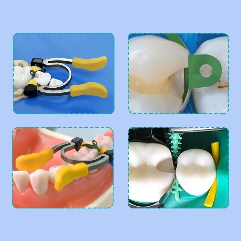 Dental Matrix Bands Sectional Matrix System Paediatric Matrices Clamp Ring+Wedge