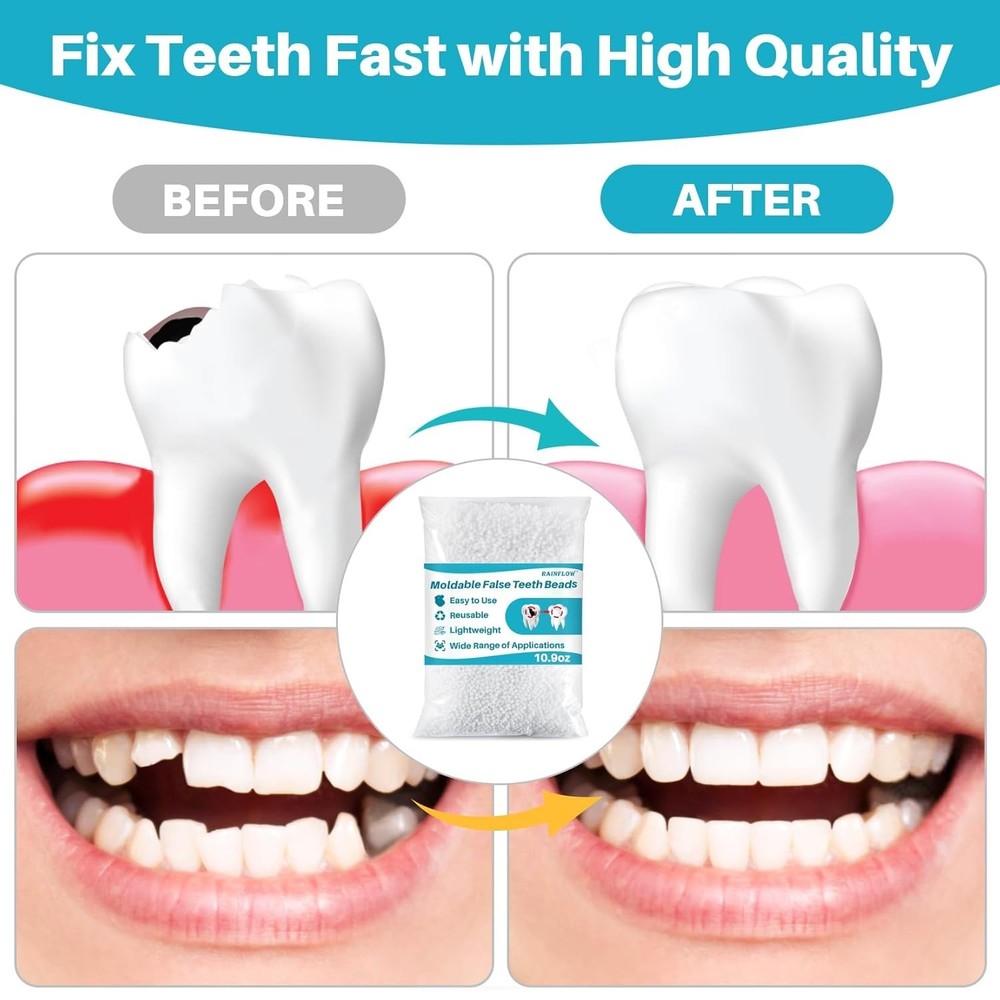 100G Bead Teeth Tooth Solid Gel Replacement Moldable Thermal Fitting Bead Teeth