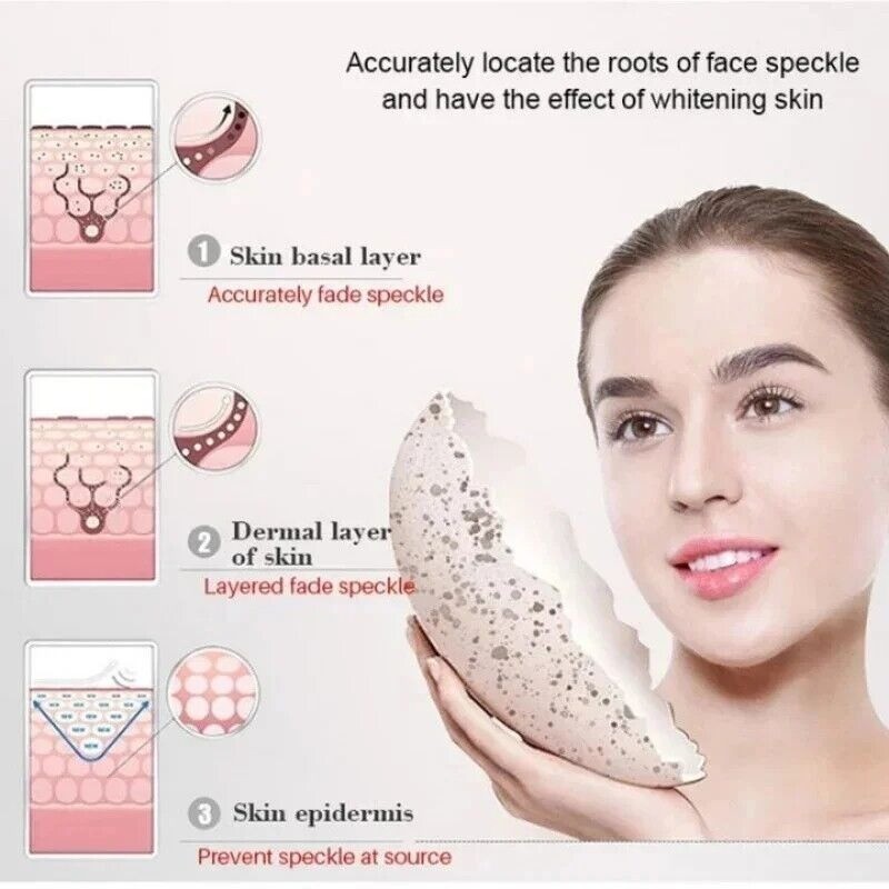 Powerful Spot-removing Whiten Cream Pigmentation Melasma Dark Spots