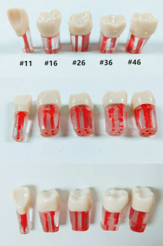5pcs Dental clear Root Canal Teeth Study Practice Model for Endodontic Pulp File