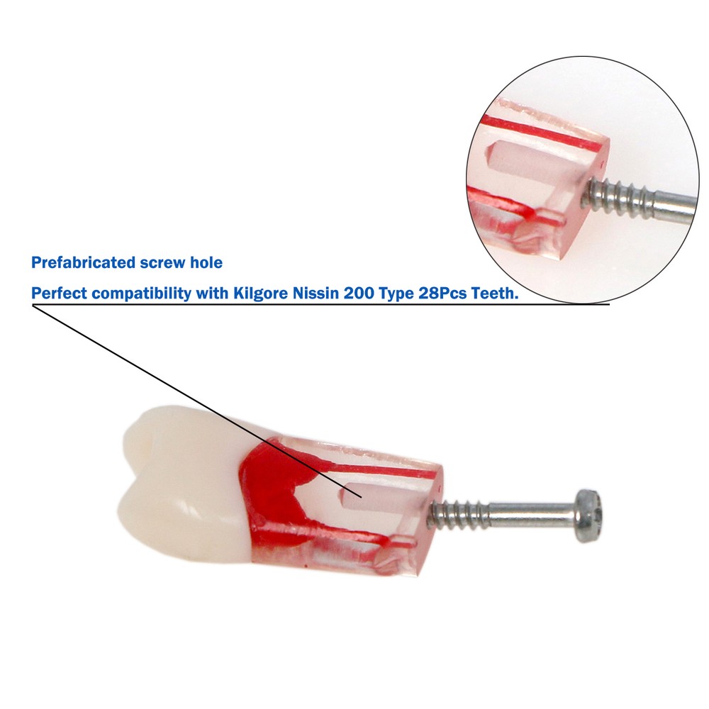 10Pcs Dental RCT Endo Root Canal Teeth Model Practice BlockPulp Cavity Study