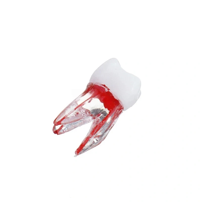 5Pcs Dental Tooth Endo Root Canal Study Model For RCT Practice Block Pulp Cavity