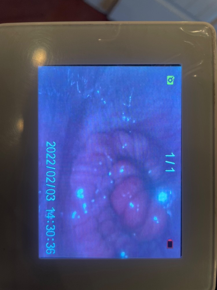 Cattle Visual Insemination Gun w/Adjustable Screen