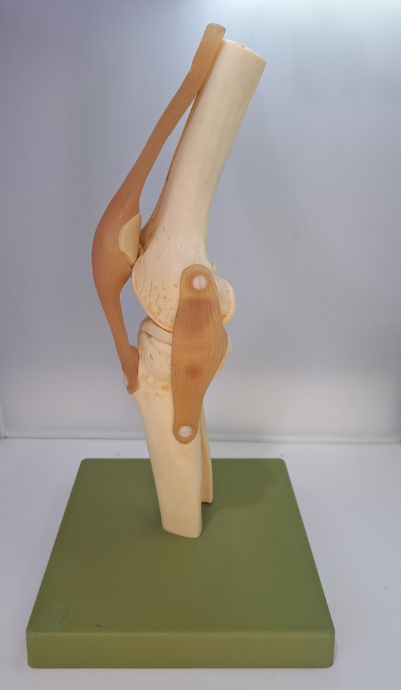 Vintage 1995 Somso Anatomical Model Functional Knee Joint Model BIN86
