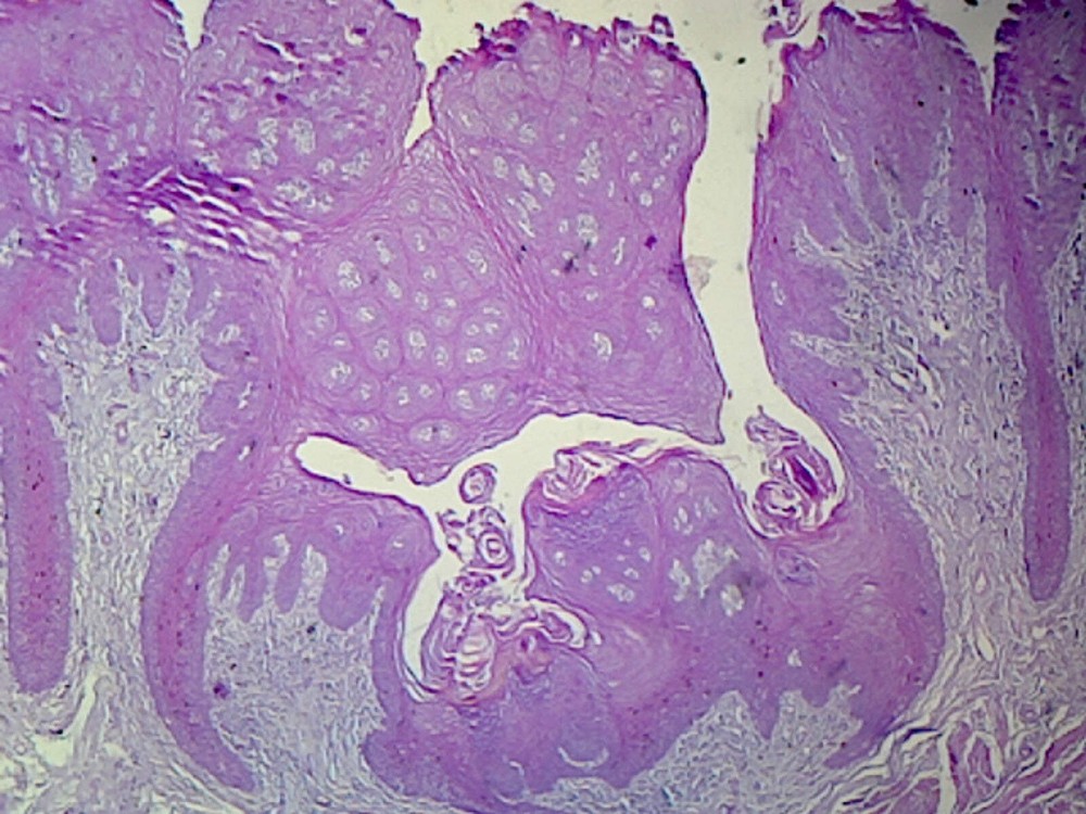 Tongue, Human; Showing General Structure; Cross Section