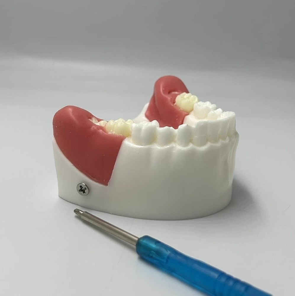 Dental Impacted Tooth Extraction Practice Model Dental Training Display