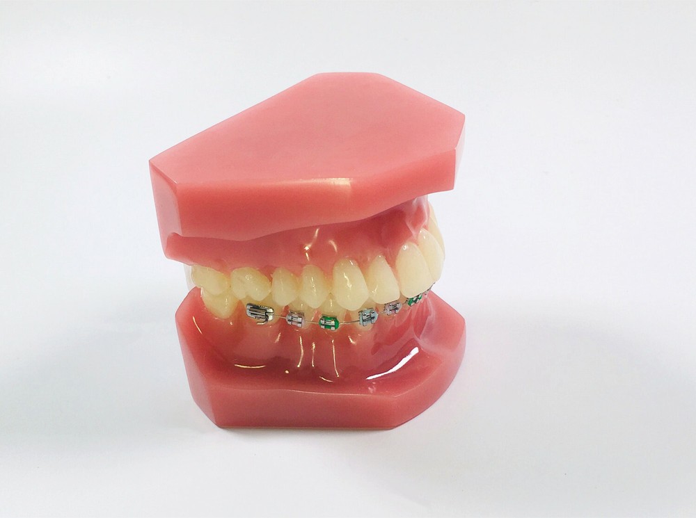 1Pc Dental Model Invisible Retainer Metal Brackets Contrast Aligner Comparison
