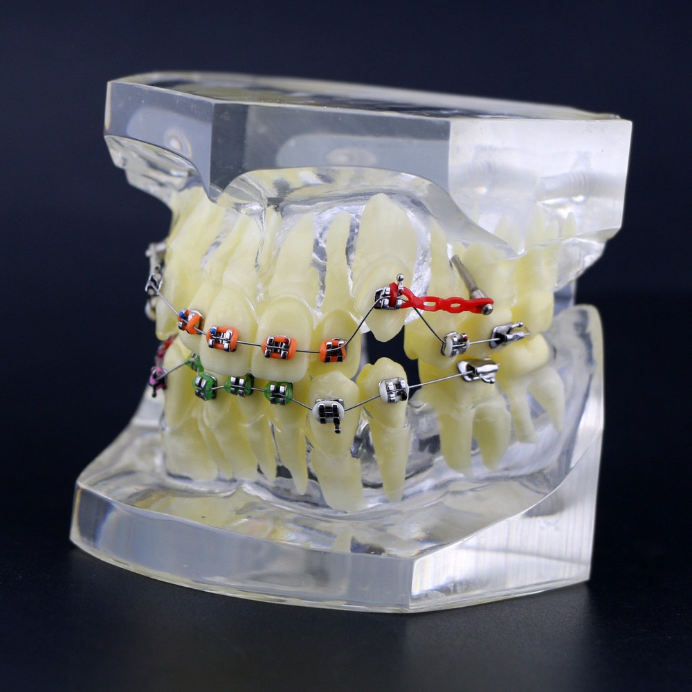 Dental Typodont Orthodontic Treatment Teeth Model Malocclusion Study w/ Bracket