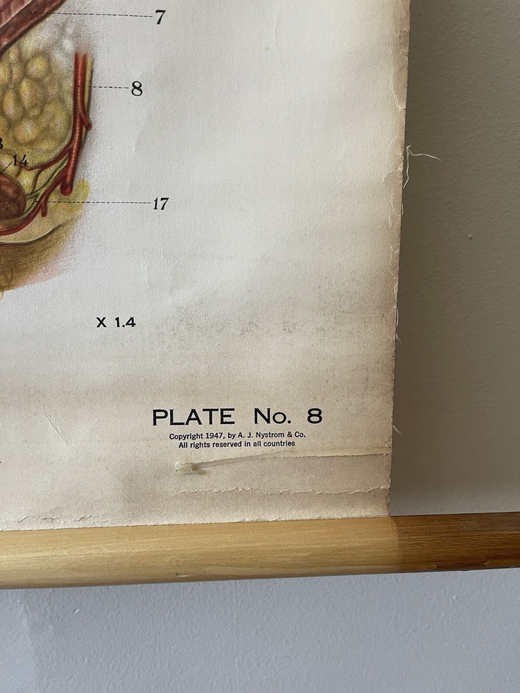 Vintage Frohse American Anatomical Pull Down Wall Chart Digestive System