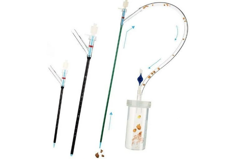 Ureteral Access Sheath with Suction – Sterile – CE Certified – Single Use