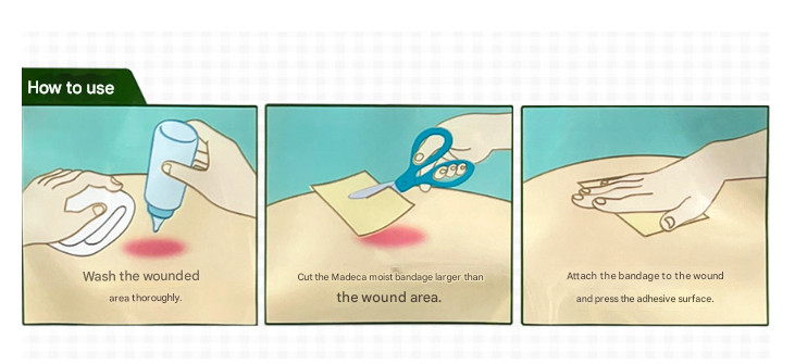 Madecassol Hydrocolloid Dressing / Bandage