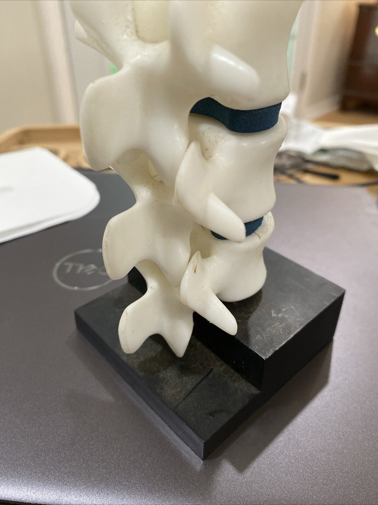 Anatomical Model Spine Vertebrae Height Educational Plastic Movable