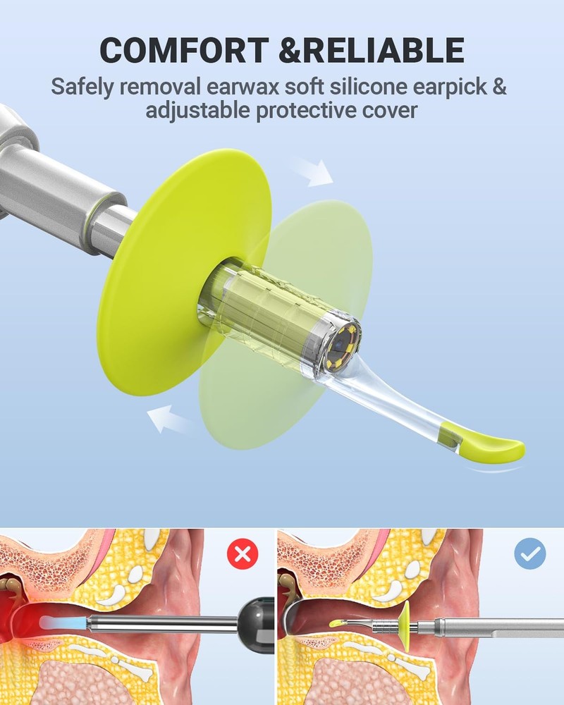AnyScope Digital Otoscope Compatible with iPhone and Android Devices, HD Ear ...