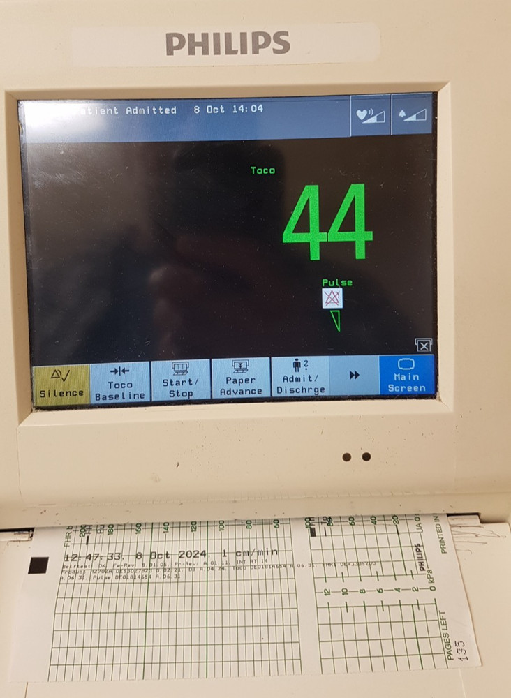 Philips TOCO MP Transducer M2734B