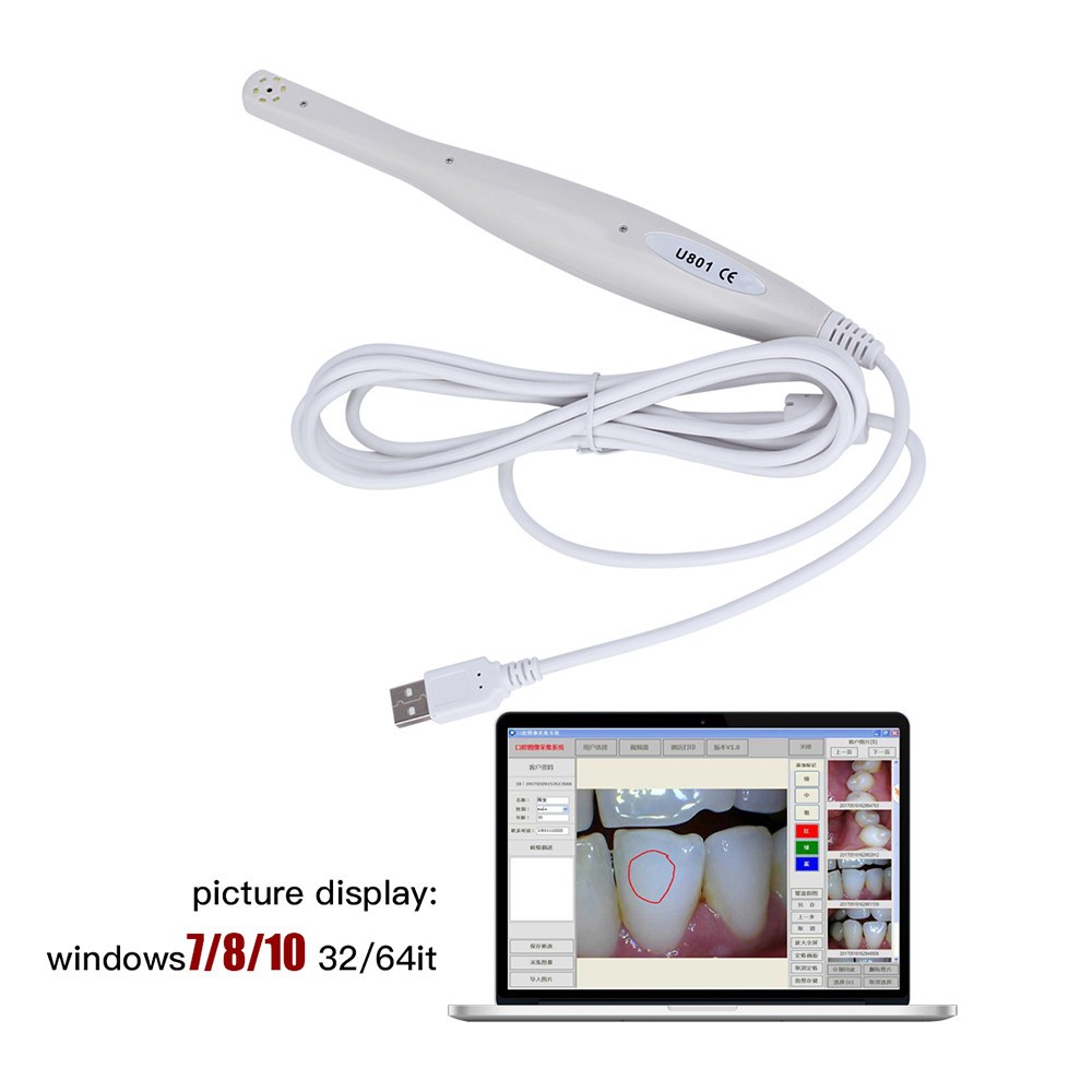 SOLARCAM 1080P USB Intraoral Camera with Software - White