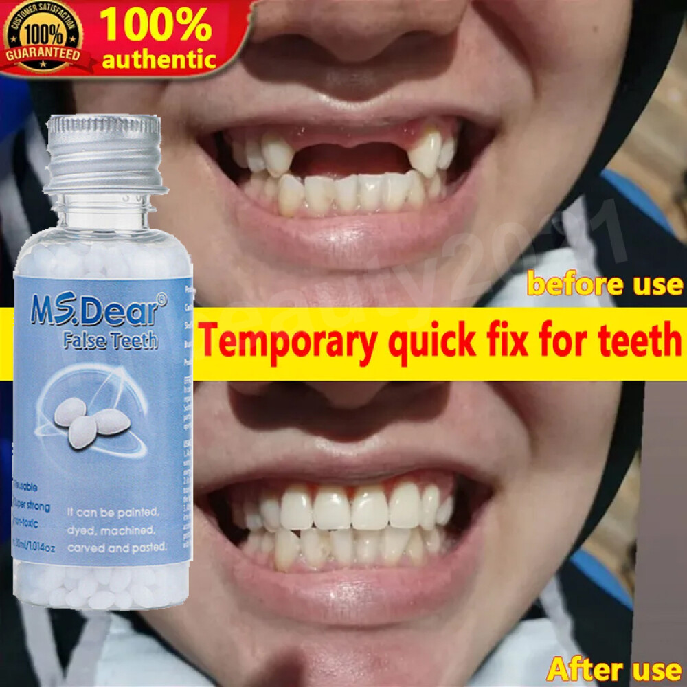 Tooth Repair Granules Temporary Kit Fitting Beads Reusable Moldable False Teet