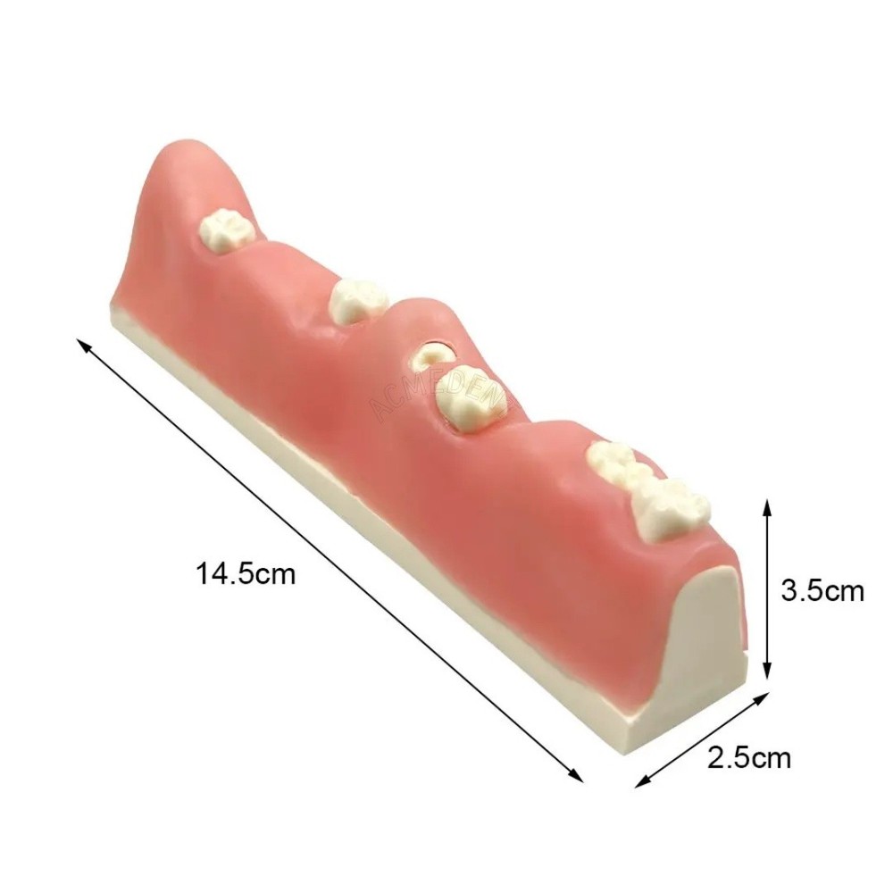 Dental Impacted Tooth Extraction Practice Model Training Gingiva Sutures Test