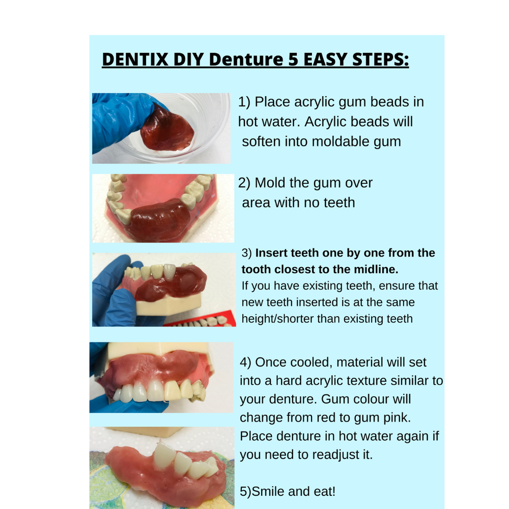 DIY Denture Basic Kit WITH Impression Kit Model Cast, Fun and Simple, Affordable