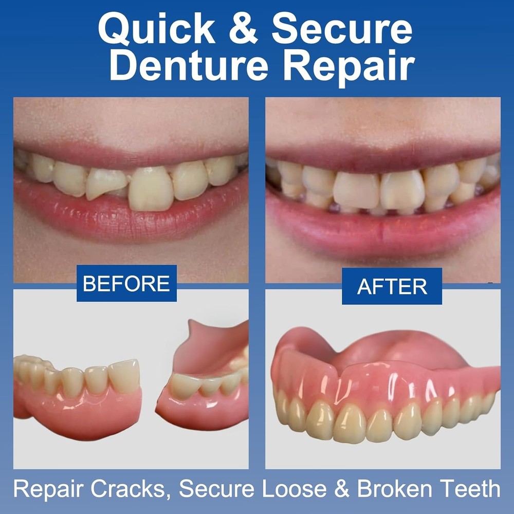 Dental Bonding Glue 1 oz New