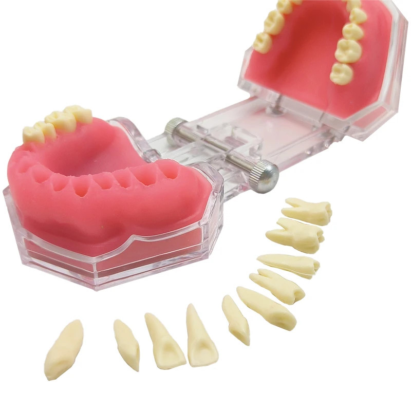 Dental Tooth Extraction Pratice Model Removable Teeth Soft Gum Typodont Model