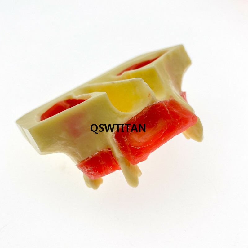 Dental Sinus Lift Practice Teeth Model Typodont Study Tooth Model M2012