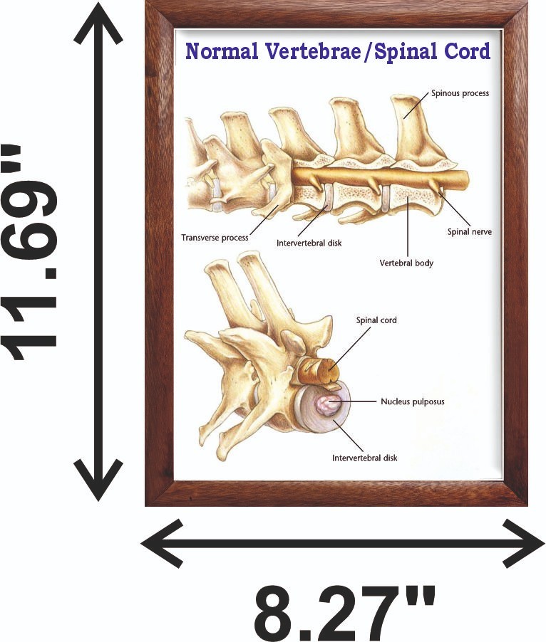 Normal Vertebrae/Spinal Cord Chart 12x18 inches