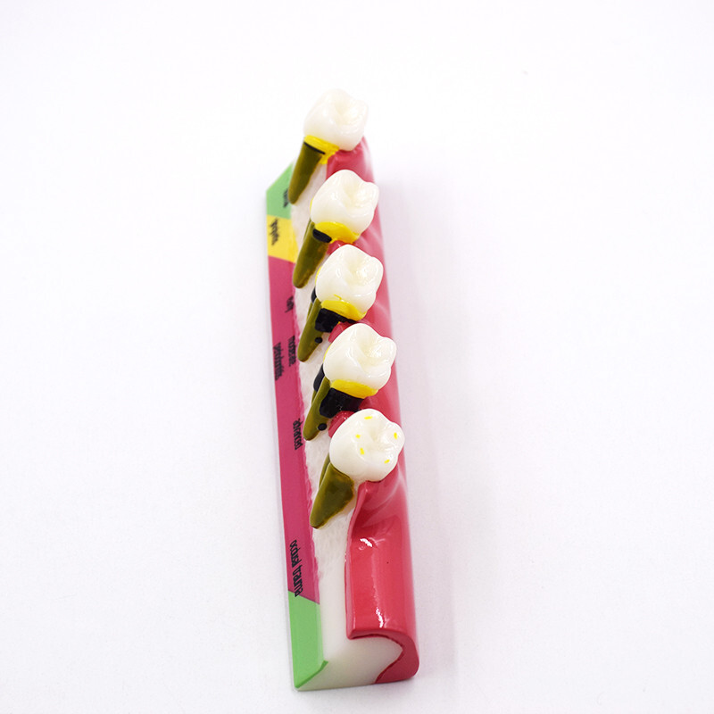 Dental High Quality Assort Dentoform Pathological Study Periodontal Model Teeth