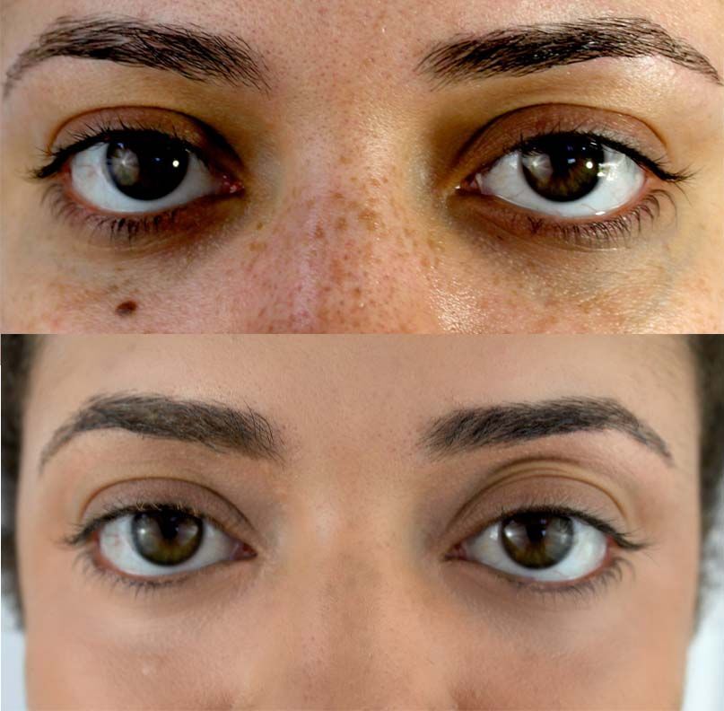 IT Cosmetics BYE BYE Illumination Under Eye FULL Coverage LIGHT MEDIUM CONCEALER