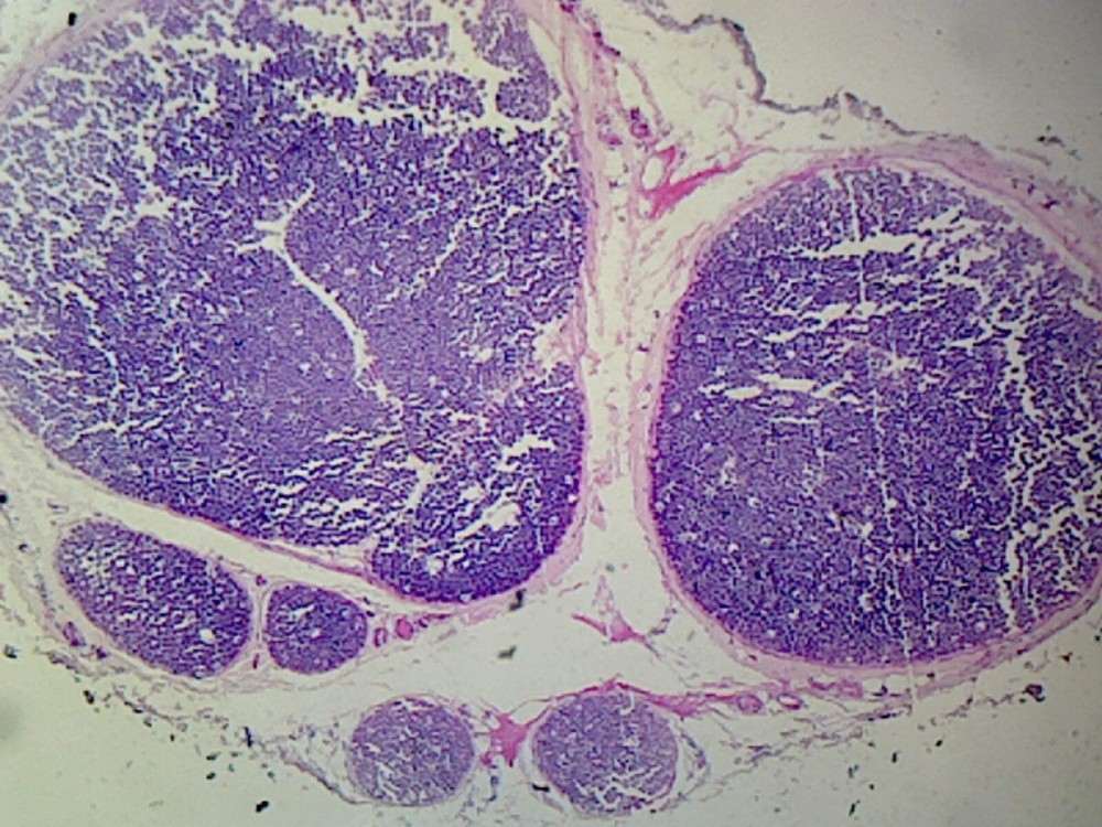 Myelinated Peripheral Nerve, Human; Cross Section
