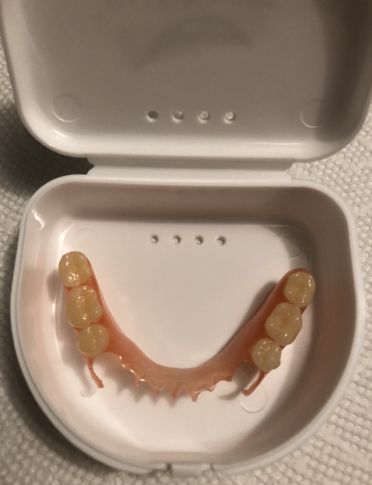 BURBANK Replacement DentalLab Partials Lower Side 6 teeth CustomMadeMissingTooth