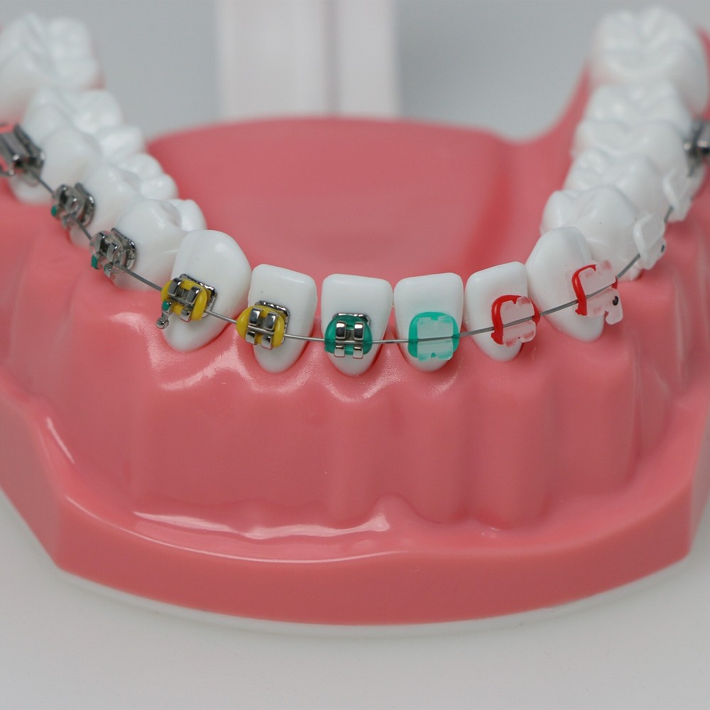 Dental Typodont Teeth Model 1:1 Teach Study Half Metal Ceramic Brackets Tubes
