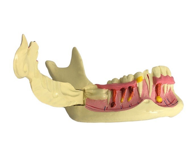 Dental Mandibular Tissue Teeth Anatomical Model Patient Teach Study Model