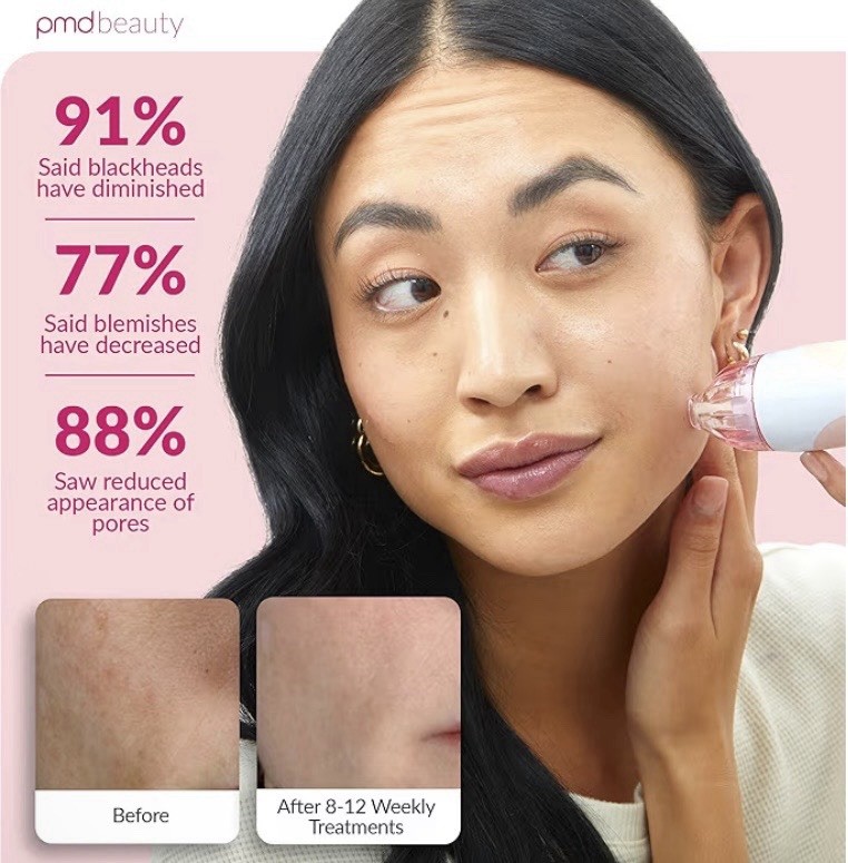 PMD Personal Microderm Classic Pink Exfoliation Device Open Box Tested